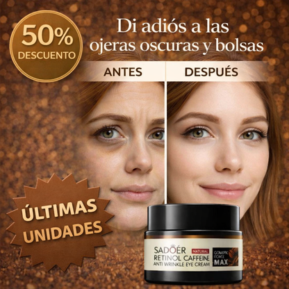 Contorno de Ojos con Cafeína (20g) – NaturEyes
